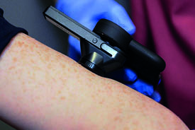 AI powered teledermatology shows considerable potential