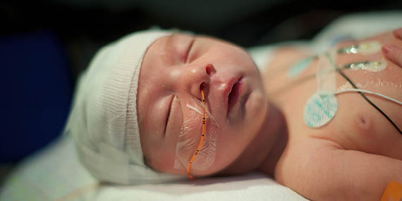 Avoidable Brain Injuries in Childbirth (ABC)